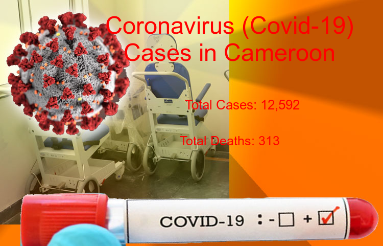 Cameroon Coronavirus Update - Covid-19 confirmed cases rise to 12,592, Total Deaths reaches to 313 on 30-Jun-2020
